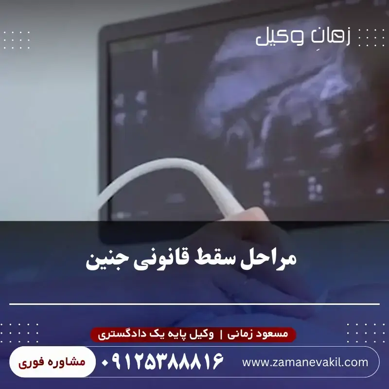 مراحل سقط قانونی جنین
